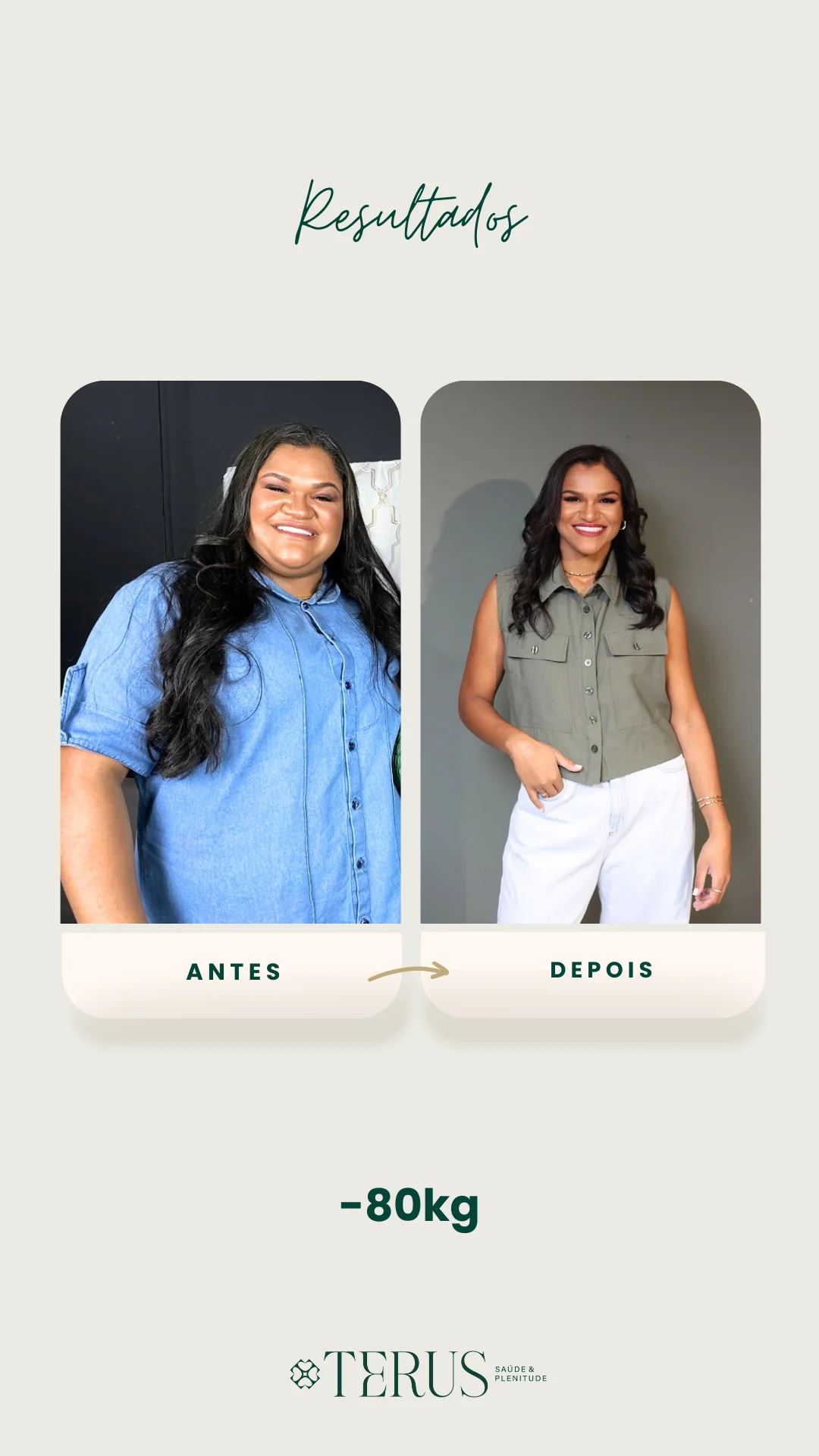 Resultado de emagrecimento antes e depois, com perda de 80 quilogramas