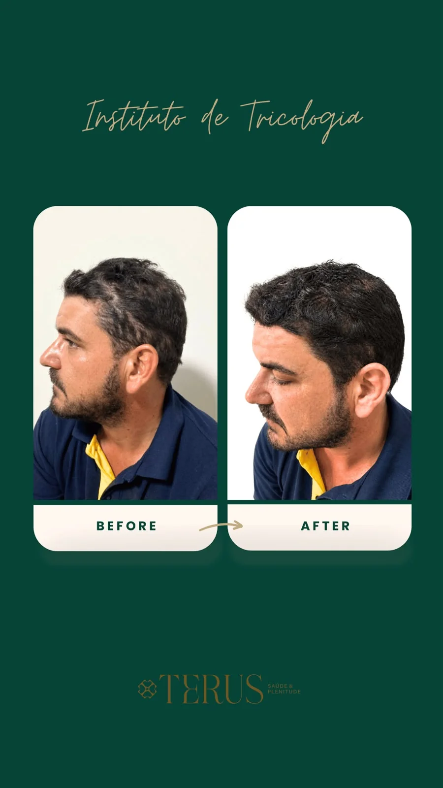 Comparativo capilar antes e depois do tratamento